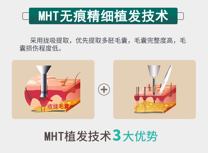 MHT�o�۾���ֲ�l���g